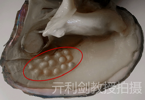 新华全媒+|“瓷娃娃”拉巴顿珠与他镜头中的世界(图1)